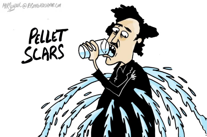 Pellet-scars-Mir-Suhail-Aug-12-2016